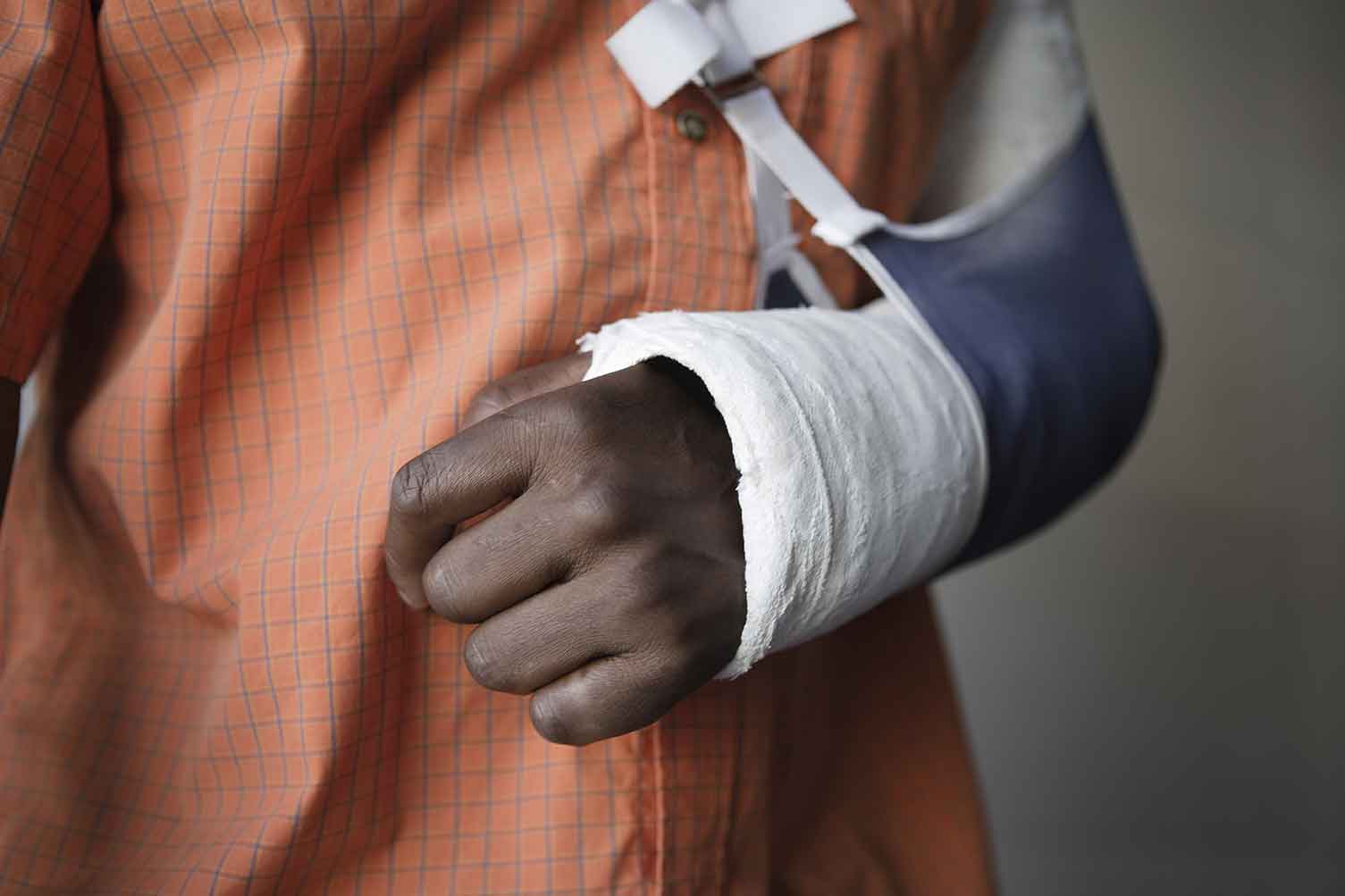 Closeup midsection of a man with broken arm in cast
